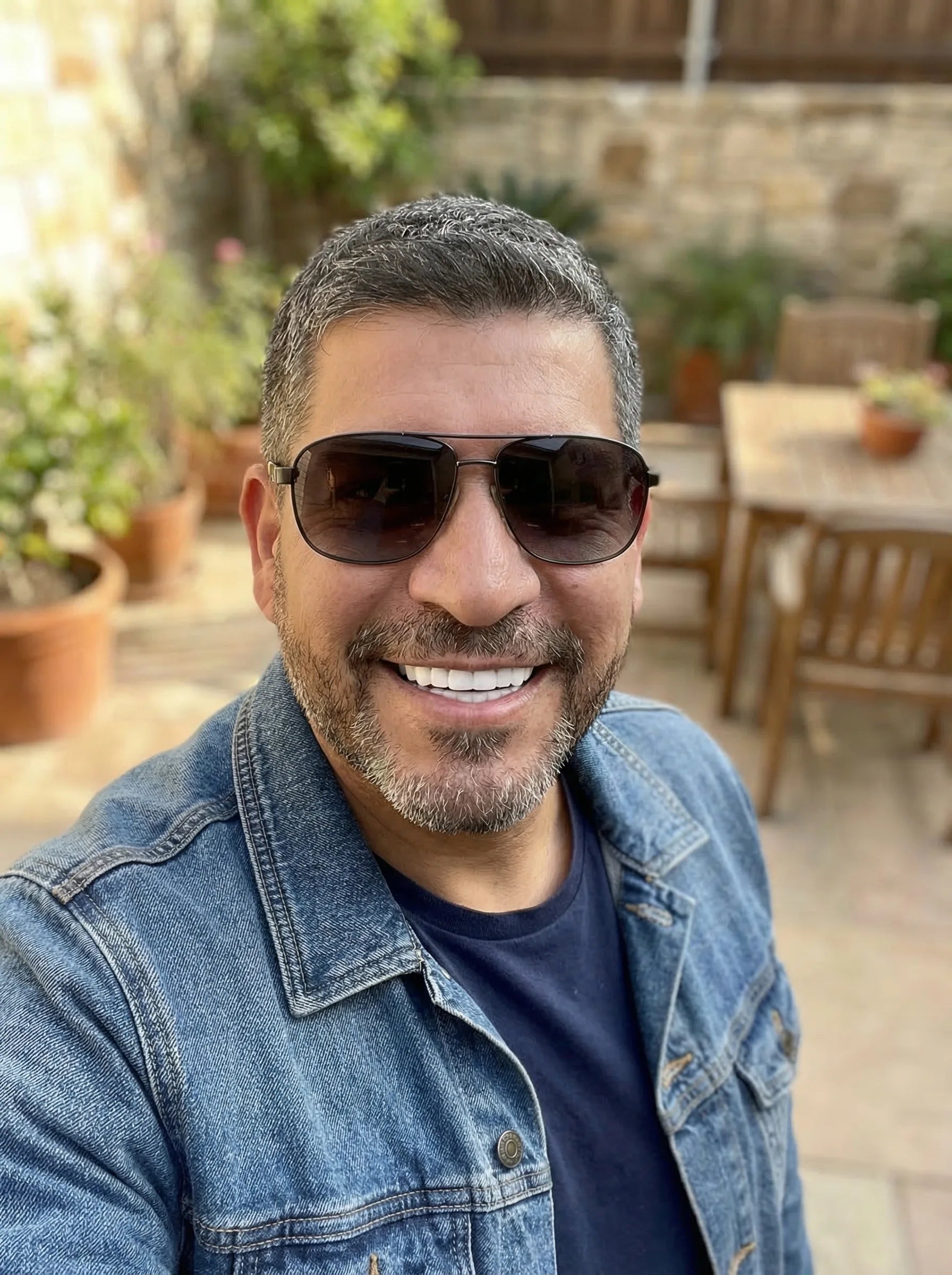 Teeth Coverings | Clip On Veneers