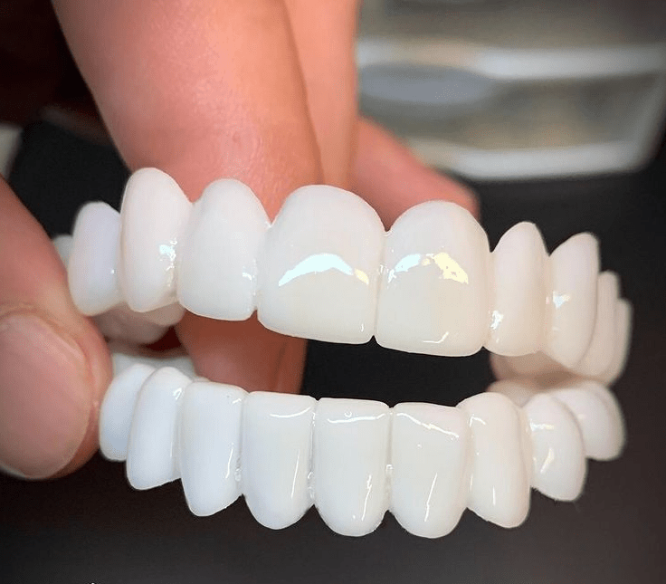 Clip On Teeth Veneers | False Teeth