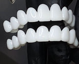 Clip On Teeth Veneers | False Teeth