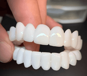 Clip On Teeth Veneers | False Teeth-Dentur-Homefinn
