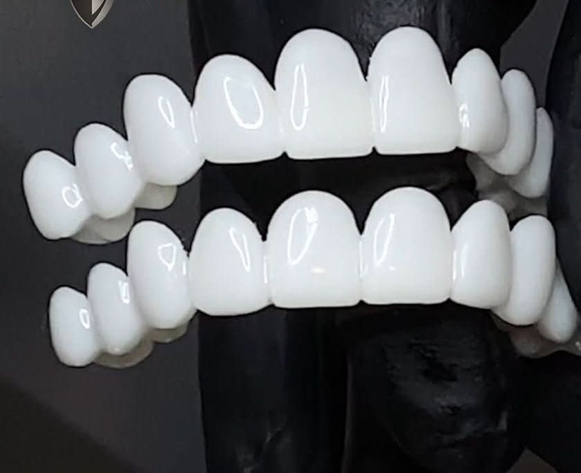 Clip On Teeth Veneers | False Teeth-Dentur-Homefinn
