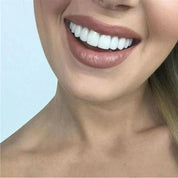 Dental Veneer Set | Removable Upper Lower Teeth Covers Storage Case-Dentures-Homefinn