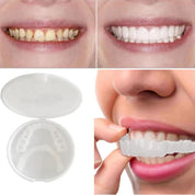 Dental Veneer Set | Removable Upper Lower Teeth Covers Storage Case-Dentures-Homefinn