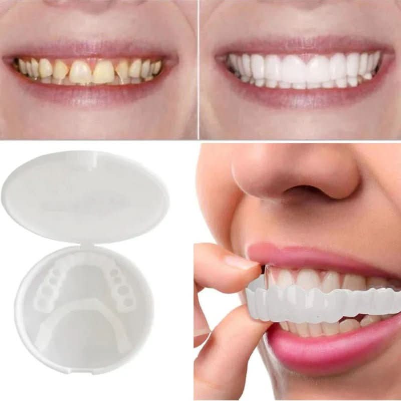 Dental Veneer Set | Removable Upper Lower Teeth Covers Storage Case-Dentures-Homefinn