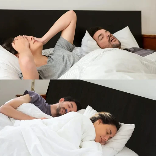 Portable Anti-Snoring Device | USB Rechargeable · Homefinn