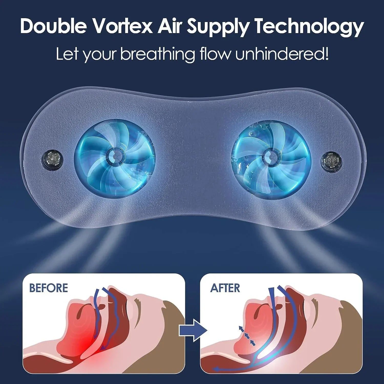 Portable Anti-Snoring Device | USB Rechargeable · Homefinn