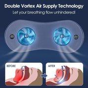 Portable Anti-Snoring Device | USB Rechargeable · Homefinn