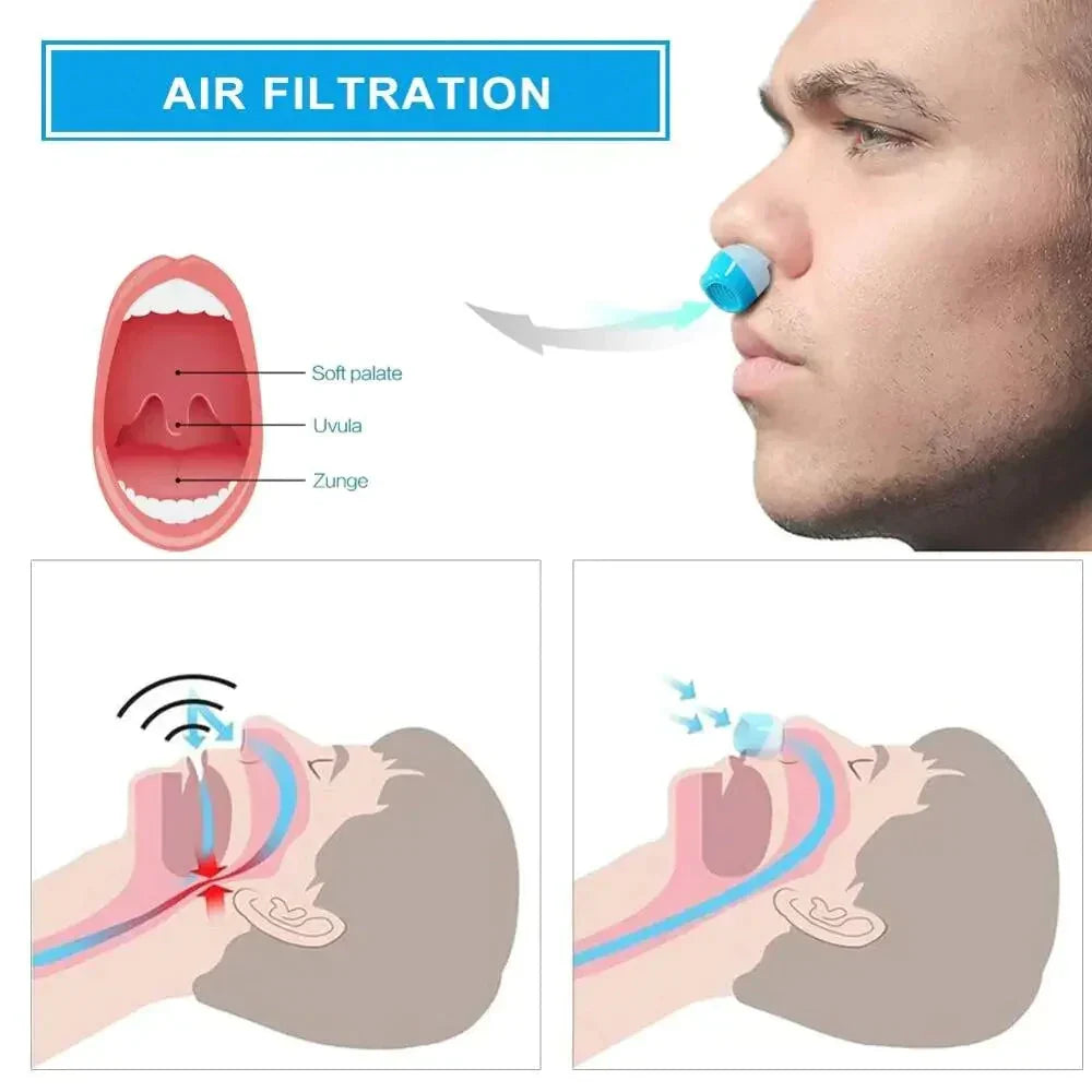 Portable Anti-Snoring Device | USB Rechargeable · Homefinn